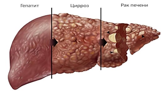 ������� � ������ ������: ������ �����, ������� ����� ����� ��� ���������� ��������